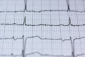 Comment l’IA peut transformer les métiers de l’énergie sans les complexifier ?